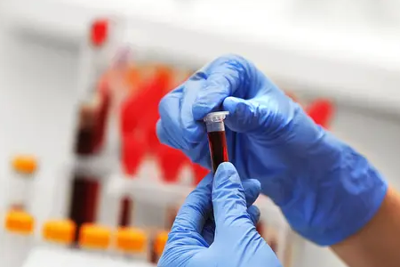 BABIO ने प्रतिदीप्ति बोवाइन गर्भावस्था रैपिड टेस्ट लॉन्च किया